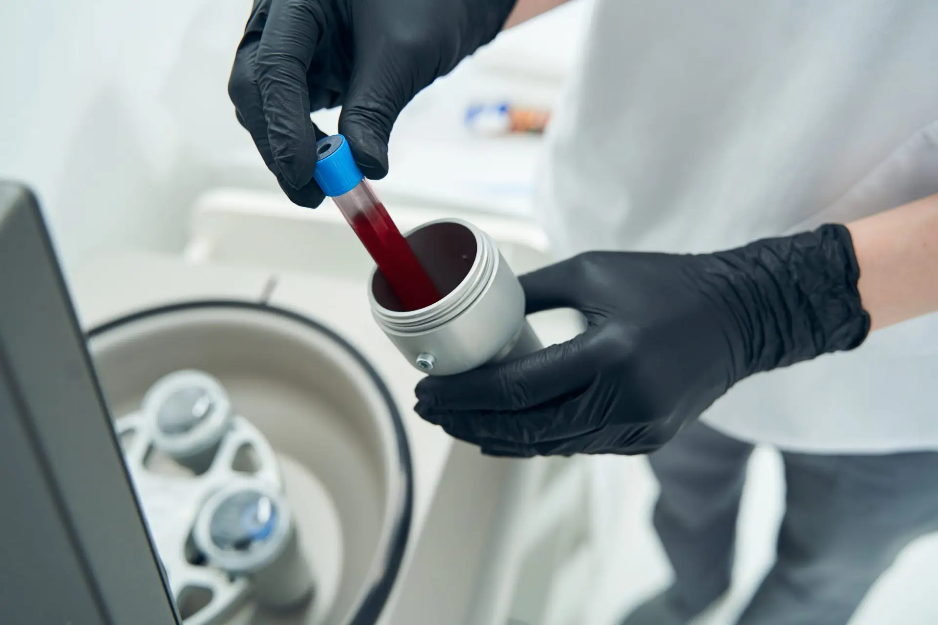 How should blood samples be transported?